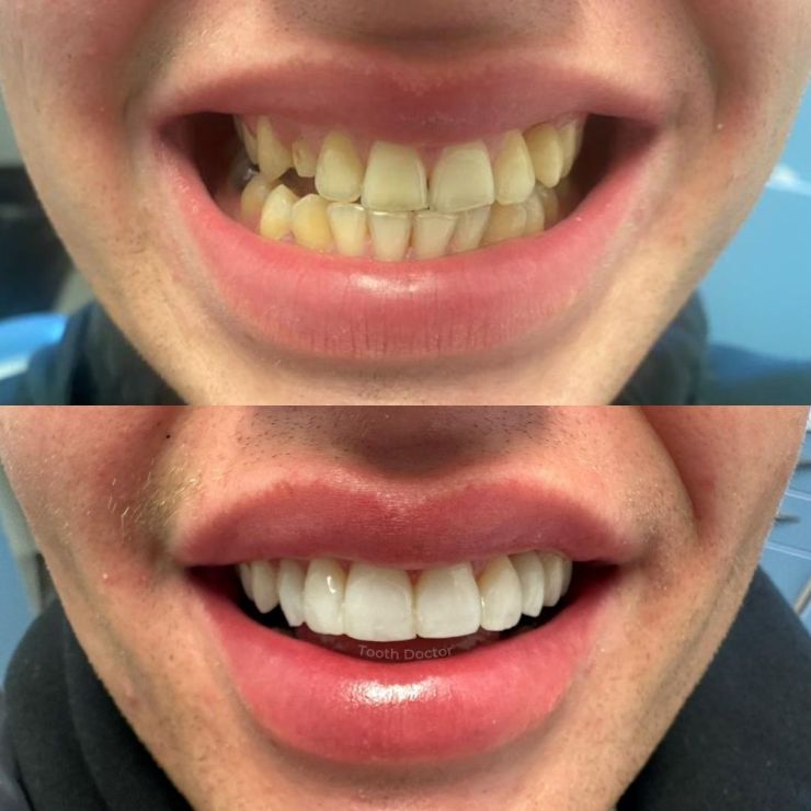 Tooth Doctor | Smile Gallery Transforming Smiles