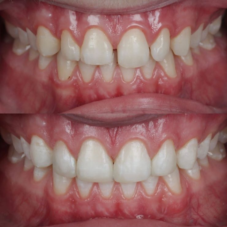 Tooth Doctor | Smile Gallery Transforming Smiles