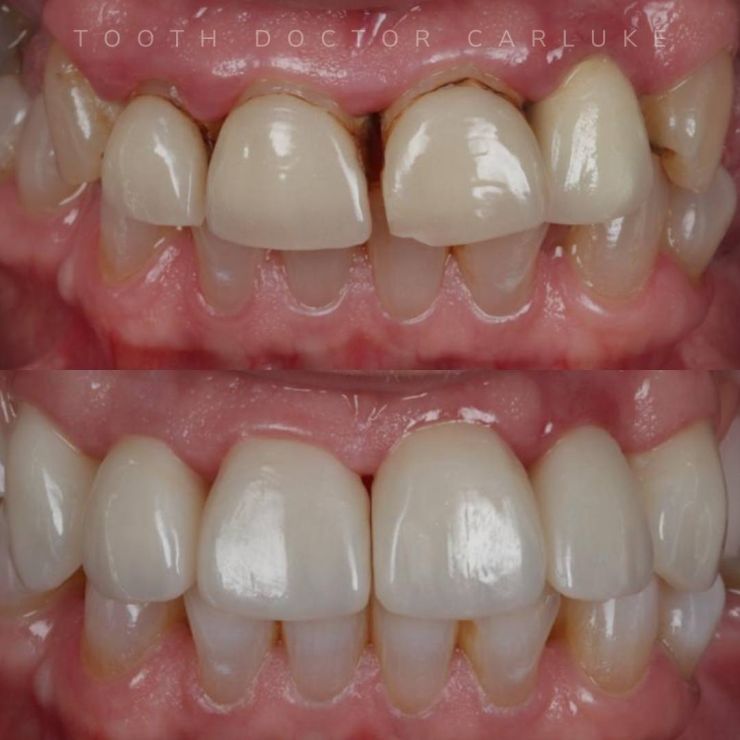 Tooth Doctor | Smile Gallery Transforming Smiles