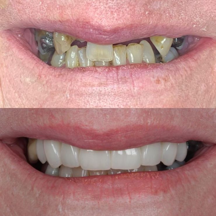 Tooth Doctor | Smile Gallery Transforming Smiles