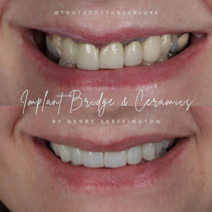 Tooth Doctor | Smile Gallery Transforming Smiles